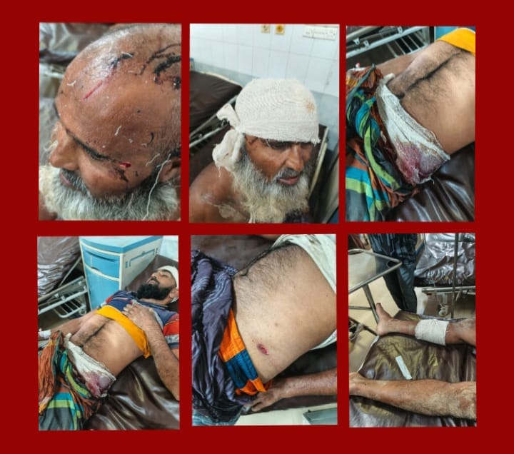 সুনামগঞ্জে জমি দখলে বাধা: দুই ভাইকে কুপিয়ে জখম