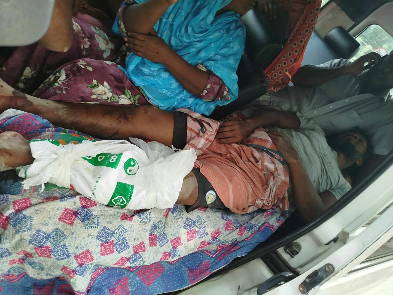 সিংড়ায় কৃষককে পিটিয়ে আহত করার অভিযোগ, রাজশাহী মেডিকেলে ভর্তি