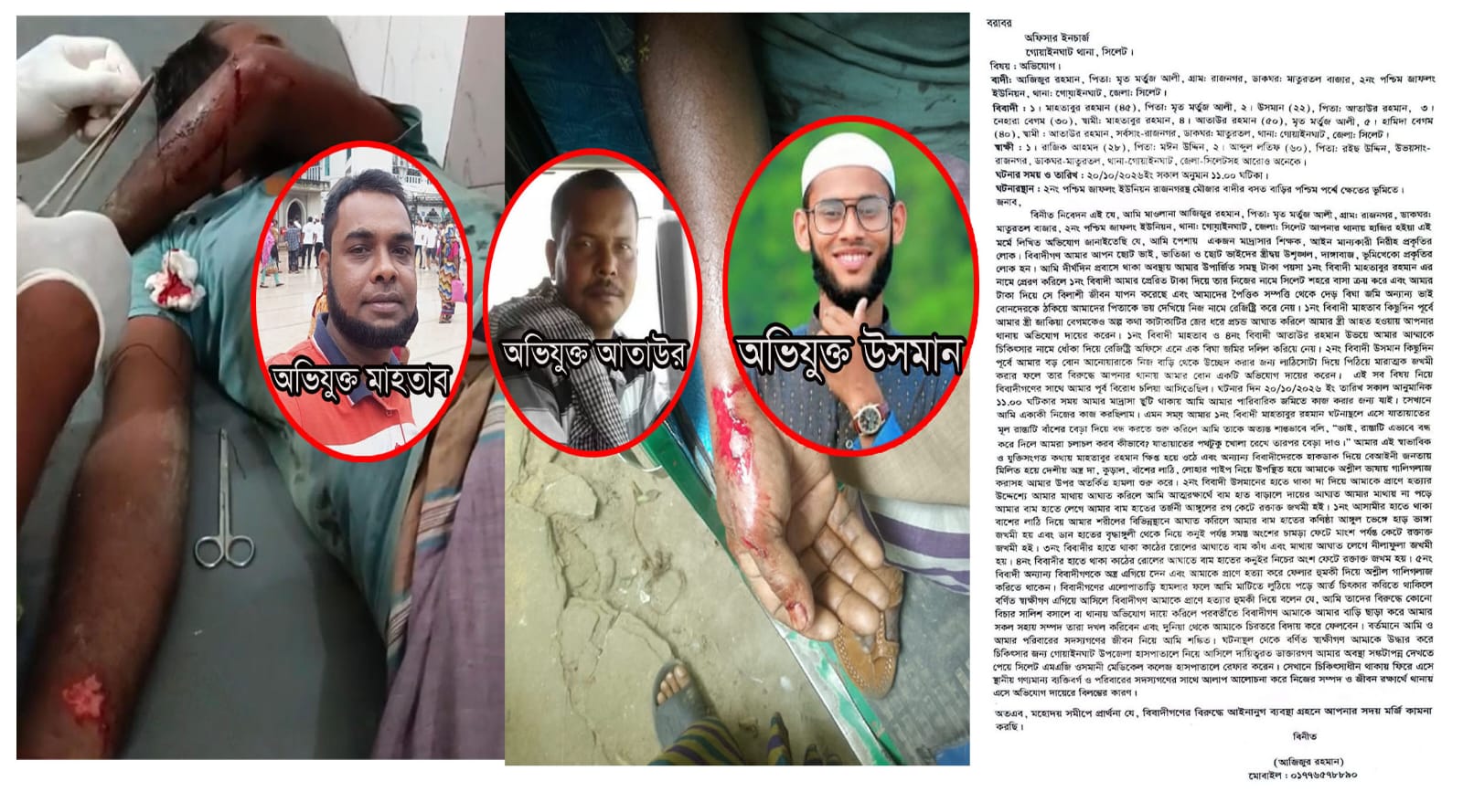 গোয়াইনঘাটে জমি নিয়ে বিরোধ: আপন দুই ভাইয়ের দ্বারা হামলার শিকার মাদ্রাসা শিক্ষক