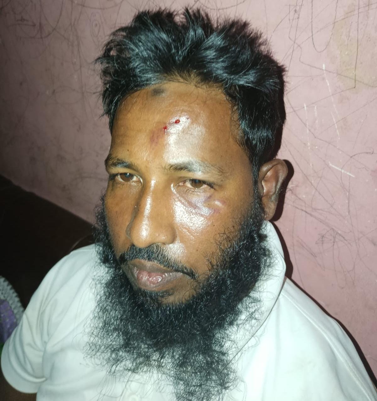 ফতুল্লায় জামায়াতের রুকনকে পিটিয়ে জখমের অভিযোগ